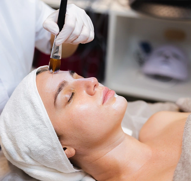 Image of a woman undergoing a chemical peel treatment, with a doctor carefully applying the peeling solution to her face.