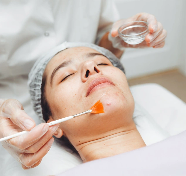 Image of a woman receiving a chemical peel treatment, as a doctor gently applies the peel solution to her face.