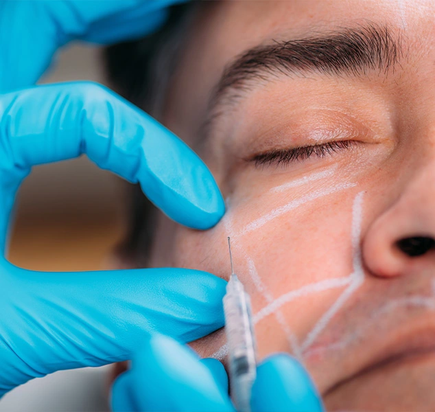 Image of a Botox procedure being performed on the cheek area of a man's face. The doctor is carefully administering injections to smooth fine lines and enhance facial contours, ensuring a precise and targeted treatment.