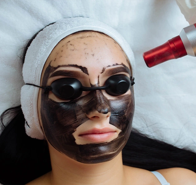 Woman receiving Carbon Q-Switched laser treatment on her face.