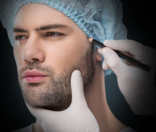 BEARD Hair Transplant