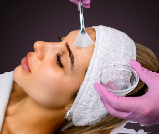 chemical peel