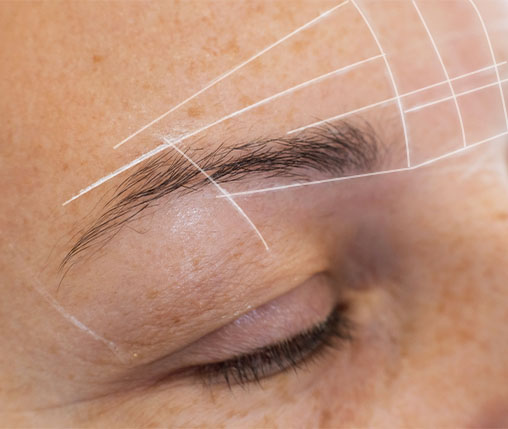 eyebrow hair transplant