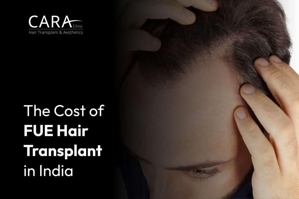 The-Cost-of-FUE-Hair-Transplant-in-India