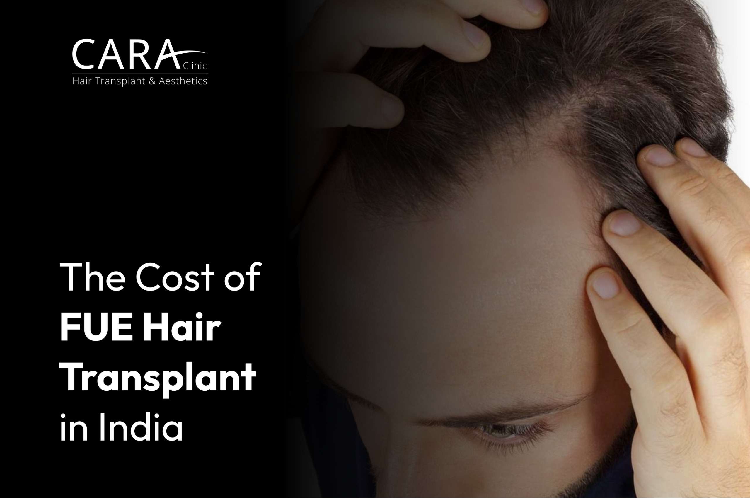The-Cost-of-FUE-Hair-Transplant-in-India
