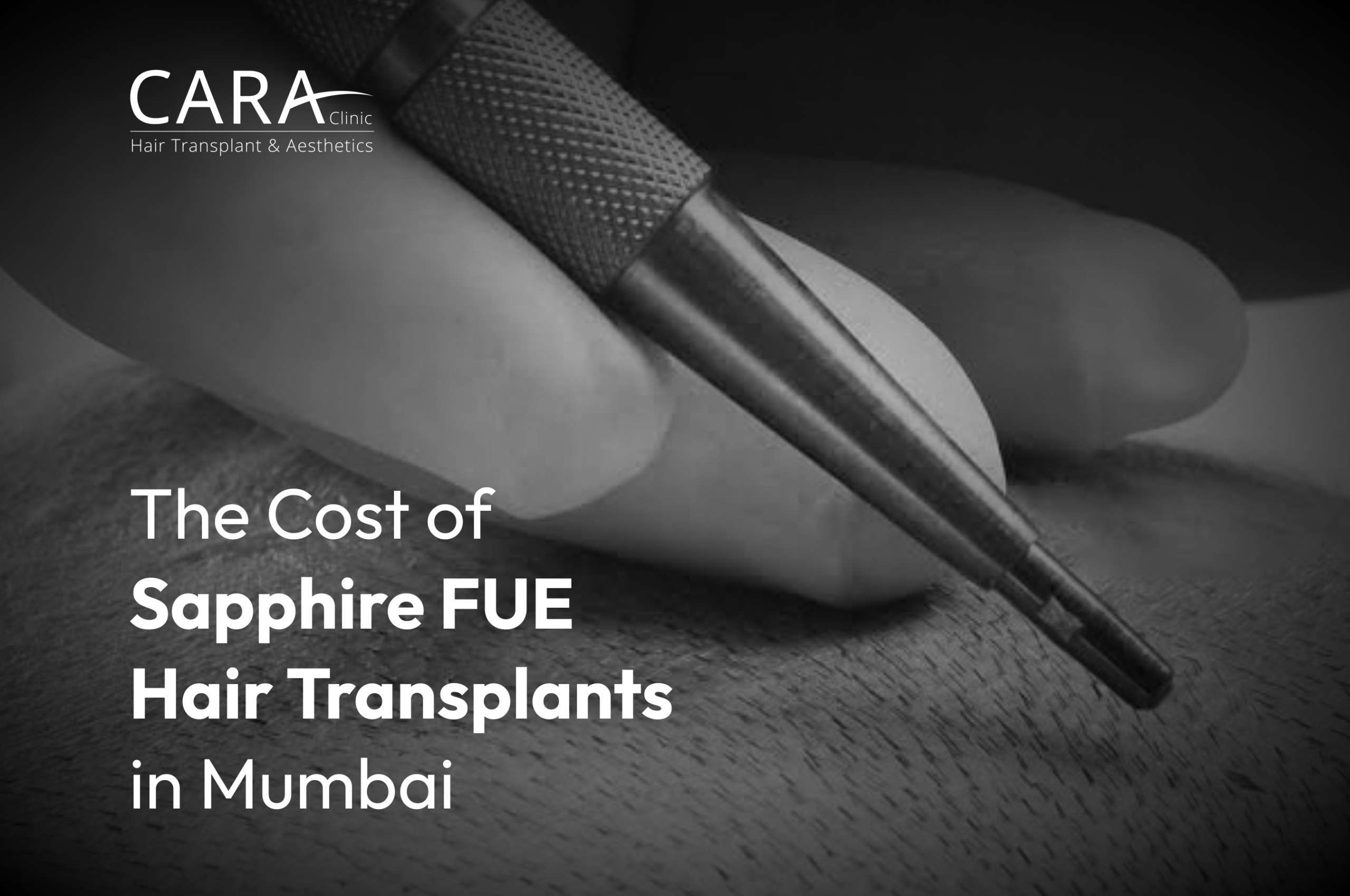 The-Cost-of-Sapphire-FUE-Hair-Transplants-in-Mumbai