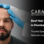 Best Hair Transplant in Santacruz Mumbai