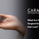 non-surgical hair loss treatment
