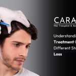 prp hair treatment cost in india
