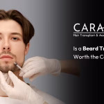 Beard Transplant in Mumbai