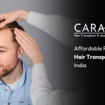 Hair Transplant Charges in Mumbai