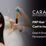 PRP treatment mumbai