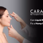 non surgical rhinoplasty near me
