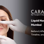 liquid nose job in mumbai